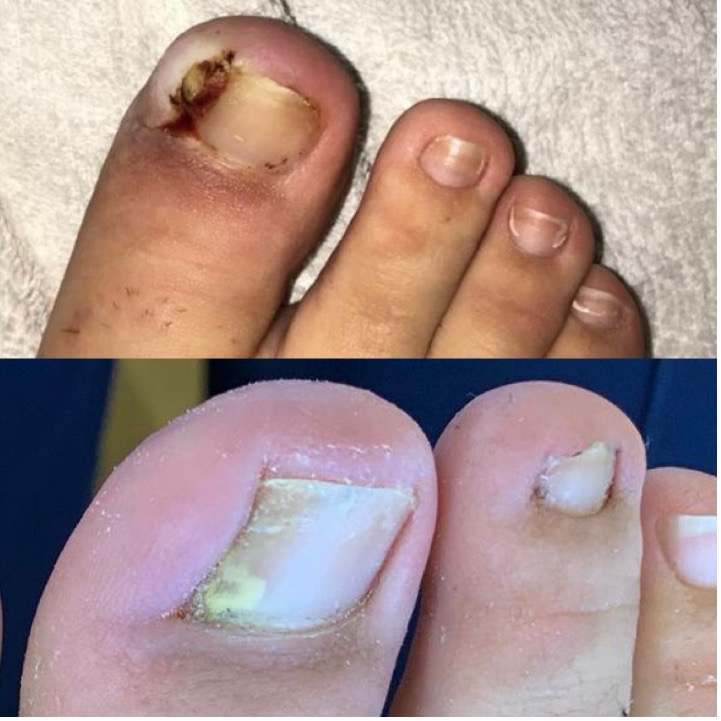 Our Team that treat Ingrown toenails & Nail Surgery